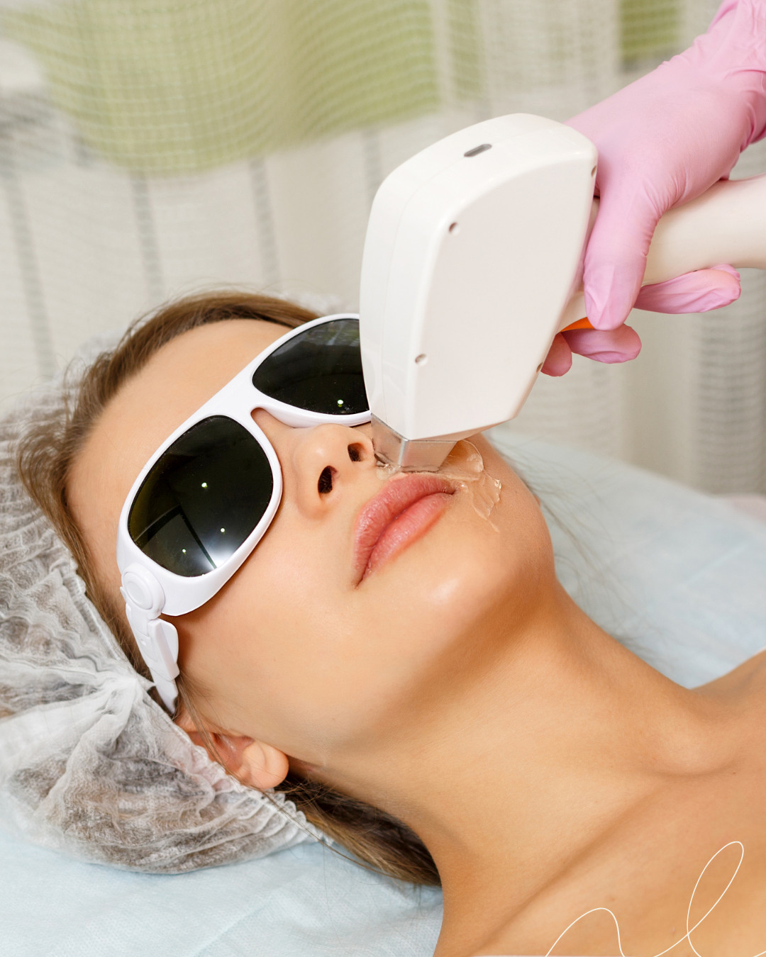 Depilação a laser na DuoBelle